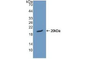 Detection of Recombinant HMGN1, Human using Polyclonal Antibody to High Mobility Group Nucleosome Binding Domain Protein 1 (HMGN1) (HMGN1 抗体  (AA 14-100))
