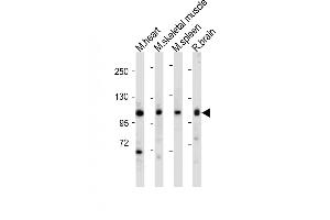 All lanes : Anti-Mouse Csf1r Antibody (C-term) at 1:1000-2000 dilution Lane 1: Mouse heart tissue lysate Lane 2: Mouse skeletal muscle tissue lysate Lane 3: Mouse spleen tissue lysate Lane 4: Rat brain tissue lysate Lysates/proteins at 20 μg per lane. (CSF1R 抗体  (C-Term))