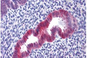 Human Uterus: Formalin-Fixed, Paraffin-Embedded (FFPE) (IDH1 抗体  (C-Term))