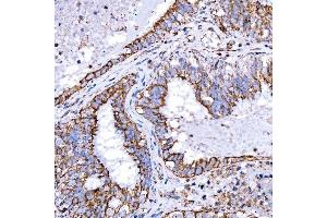 IHC analysis of RAB7/RAB7A using anti-RAB7/RAB7A antibody (ABIN7600597). (RAB7A 抗体  (AA 21-177))