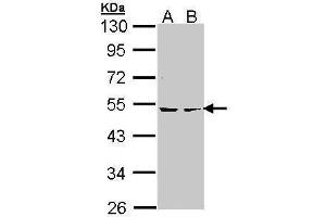 WB Image Sample (30 ug of whole cell lysate) A: Hela B: Hep G2 , 10% SDS PAGE antibody diluted at 1:1000 (PKA 2 beta (Center) 抗体)