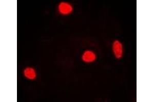 Immunofluorescent analysis of RNF40 staining in MCF7 cells. (RNF40 抗体)