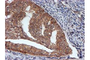 Image no. 4 for anti-Histidyl-tRNA Synthetase 2, Mitochondrial (Putative) (HARS2) antibody (ABIN1498584)