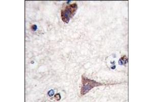 Image no. 1 for anti-B-Raf proto-oncogene, serine/threonine kinase (BRAF) (Thr400) antibody (ABIN360131)