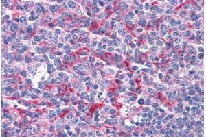 Human Tonsil: Formalin-Fixed, Paraffin-Embedded (FFPE) (GABPB1 抗体  (AA 198-210))