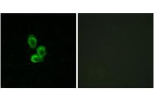 Immunofluorescence analysis of HepG2 cells, using PDGF Receptor beta (Ab-751) Antibody. (PDGFRB 抗体  (AA 718-767))