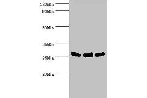 Western blot All lanes: Adenylate kinase 2, mitochondrial antibody at 5 μg/mL Lane 1: Hela whole cell lysate Lane 2: Mouse kidney tissue Lane 3: Mouse small intestine tissue Secondary Goat polyclonal to rabbit IgG at 1/10000 dilution Predicted band size: 27, 26, 23, 15, 25, 22 kDa Observed band size: 27 kDa (Adenylate Kinase 2 抗体  (AA 1-232))