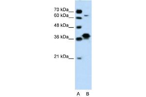 WB Suggested Anti-FOSL1 Antibody Titration: 0. (FOSL1 抗体  (Middle Region))