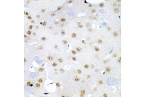 Immunohistochemistry of paraffin-embedded mouse brain using CDC27 antibody (ABIN5975347) at dilution of 1/200 (40x lens). (CDC27 抗体)