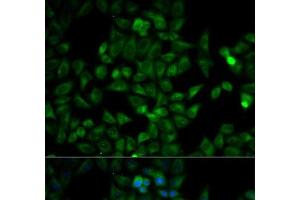 Immunofluorescence analysis of HeLa cells using TPI1 Polyclonal Antibody (TPI1 抗体)