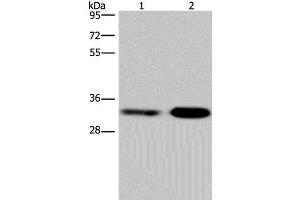 Western Blot analysis of Jurkat and NIH/3T3 cell using CDK5 Polyclonal Antibody at dilution of 1:300 (CDK5 抗体)