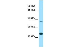 Western Blotting (WB) image for anti-Ependymin Related Protein 1 (Zebrafish) (EPDR1) (N-Term) antibody (ABIN2789381) (EPDR1 抗体  (N-Term))