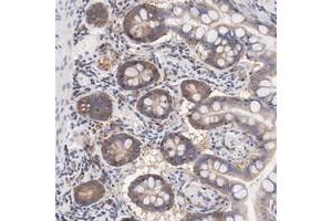 Immunohistochemical staining of human small intestine with SETD3 polyclonal antibody  shows moderate cytoplasmic positivity in glandular cells.
