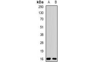 Western blot analysis of Rpp20 expression in MCF7 (A), SW480 (B) whole cell lysates. (POP5 抗体)