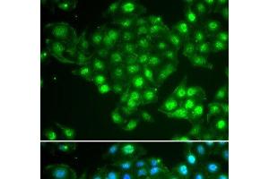 Immunofluorescence analysis of HeLa cells using ABCA3 Polyclonal Antibody (ABCA3 抗体)