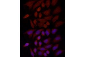 Immunofluorescence (IF) image for anti-Sterol Regulatory Element Binding Transcription Factor 1 (SREBF1) (AA 1-100) antibody (ABIN7270598)