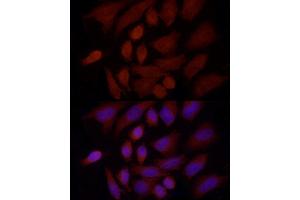Immunofluorescence analysis of HeLa cells using SREBF1 Rabbit pAb (ABIN7270598) at dilution of 1:100 (40x lens). (SREBF1 抗体  (AA 1-100))