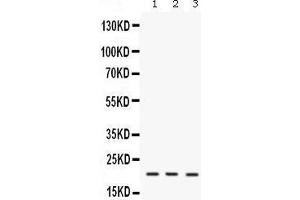 Western blot analysis of IL7 expression in mouse brain extract (lane 1), mouse thymus extract (lane 2) and NIH3T3 whole cell lysates (lane 3). (IL-7 抗体  (AA 26-154))