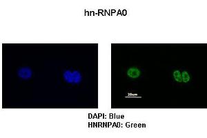 Sample Type :  MCF7 cells   Primary Antibody Dilution :   1:200   Secondary Antibody:  Anti-rabbit-FITC   Secondary Antibody Dilution:   1:500   Color/Signal Descriptions:  DAPI: Blue hn-RNPA0: Green   Gene Name:  HNRPA0   Submitted by:  Anonymous (HNRNPA0 抗体  (Middle Region))