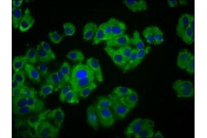 Immunofluorescence staining of HepG2 cells with ABIN7165474 at 1:133, counter-stained with DAPI. (ITFG3 抗体  (AA 115-251))