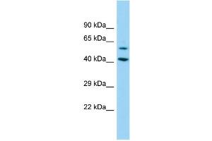 Host: Rabbit Target Name: DEPDC1B Sample Type: 293T Whole Cell lysates Antibody Dilution: 1. (DEPDC1B 抗体  (N-Term))