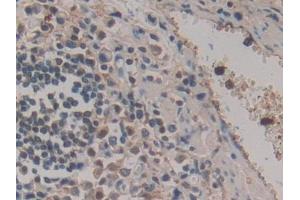 Immunohistochemistry (IHC) image for anti-Haptoglobin Related Protein (HPR) (AA 70-332) antibody (ABIN7443218)