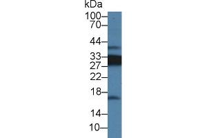 Detection of CD74 in Rat Spleen lysate using Polyclonal Antibody to Cluster Of Differentiation 74 (CD74) (CD74 抗体  (AA 65-277))