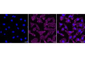 Immunocytochemical staining of HepG2 cells with ELP4 antibody (ABIN7798433), 1:1,000).