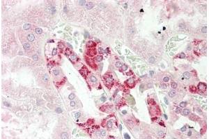 Human Kidney: Formalin-Fixed, Paraffin-Embedded (FFPE) (CUTA 抗体  (AA 71-120))