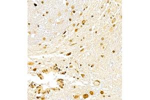 Immunohistochemistry of paraffin embedded rat spinal cord using USP27 (ABIN7076113) at dilution of 1:700 (400x lens) (USP27X 抗体)