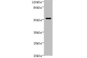 Western blot All lanes: STARD3 Antibody at 6 μg/mL + MCF-7 whole cell lysate Secondary Goat polyclonal to rabbit IgG at 1/10000 dilution Predicted band size: 51, 49, 50 kDa Observed band size: 51 kDa (STARD3 抗体  (AA 170-445))