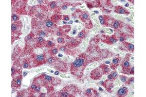 IHC Information: Liver, Human: Formalin-Fixed, Paraffin-Embedded (FFPE) (ACAA1 抗体  (N-Term))