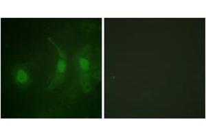 Immunofluorescence analysis of HeLa cells, using IRF-3 (Phospho-Ser385) Antibody. (IRF3 抗体  (pSer385))