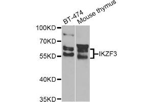 Western blot analysis of extracts of various cell lines, using IKZF3 Antibody (ABIN4904027) at 1:1000 dilution. (IKZF3 抗体)