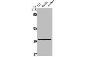 Western Blot analysis of NIH-3T3 HuvEc Jurkat cells using MAGE-C2 Polyclonal Antibody (MAGEC2 抗体  (Internal Region))