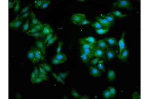 Immunofluorescence staining of HepG2 cells with ABIN7153511 at 1:93, counter-stained with DAPI. (GABARAP 抗体  (AA 2-117))