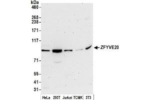 anti-Zinc Finger, FYVE Domain Containing 20 (ZFYVE20) (AA 734-784) antibody