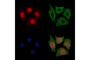 Anillin Antibody staining HepG2 cells by IF/ICC. (Anillin 抗体  (C-Term))