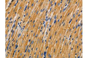 ABIN6259854 and ABIN6266844 at 1/100 staining Rat heart tissue by IHC-P.