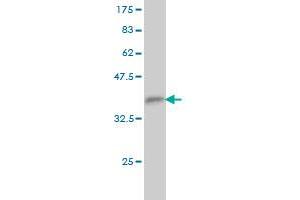 Western Blot detection against Immunogen (35. (TFCP2 抗体  (AA 414-502))