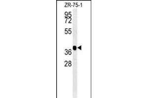 NIL2 Antibody (N-term) (ABIN651598 and ABIN2840315) western blot analysis in ZR-75-1 cell line lysates (35 μg/lane). (NIPAL2 抗体  (N-Term))