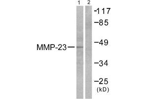 Western Blotting (WB) image for anti-Matrix Metallopeptidase 23 (MMP23) (C-Term) antibody (ABIN1848685) (Matrix Metallopeptidase 23 (MMP23) (C-Term) 抗体)