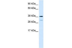 Western Blotting (WB) image for anti-Vacuolar Protein Sorting 72 Homolog (S. Cerevisiae) (VPS72) (Middle Region) antibody (ABIN1109499)