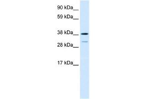 Human Lung; WB Suggested Anti-TCFL1 Antibody Titration: 0.