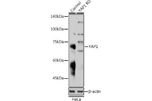 Western blot analysis of extracts from normal (control) and Y Rabbit pAb knockout (KO) HeLa cells, using Y Rabbit pAb antibody (ABIN6132788, ABIN6150316, ABIN6150321 and ABIN6215135) at 1:1000 dilution. (YAP1 抗体  (AA 155-504))