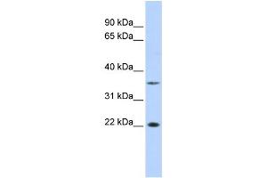WB Suggested Anti-C16orf80 Antibody Titration:  0. (C16orf80 抗体  (Middle Region))