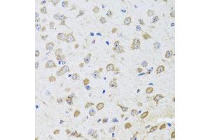 Immunohistochemistry of paraffin-embedded mouse brain using ARL6 antibody at dilution of 1:100 (x40 lens). (ARL6 抗体)