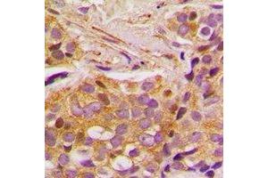 Immunohistochemistry (IHC) image for anti-SRSF Protein Kinase 1 (SRPK1) antibody (ABIN7308374) (SRPK1 抗体)