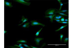 Immunofluorescence of purified MaxPab antibody to OAS1 on HeLa cell. (OAS1 抗体  (AA 1-364))