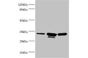 Western blot All lanes: CAPZB antibody at 6 μg/mL Lane 1: 293T whole cell lysate Lane 2: A431 whole cell lysate Lane 3: Jurkat whole cell lysate Secondary Goat polyclonal to rabbit IgG at 1/10000 dilution Predicted band size: 32, 31 kDa Observed band size: 32, 31 kDa (CAPZB 抗体  (AA 1-272))